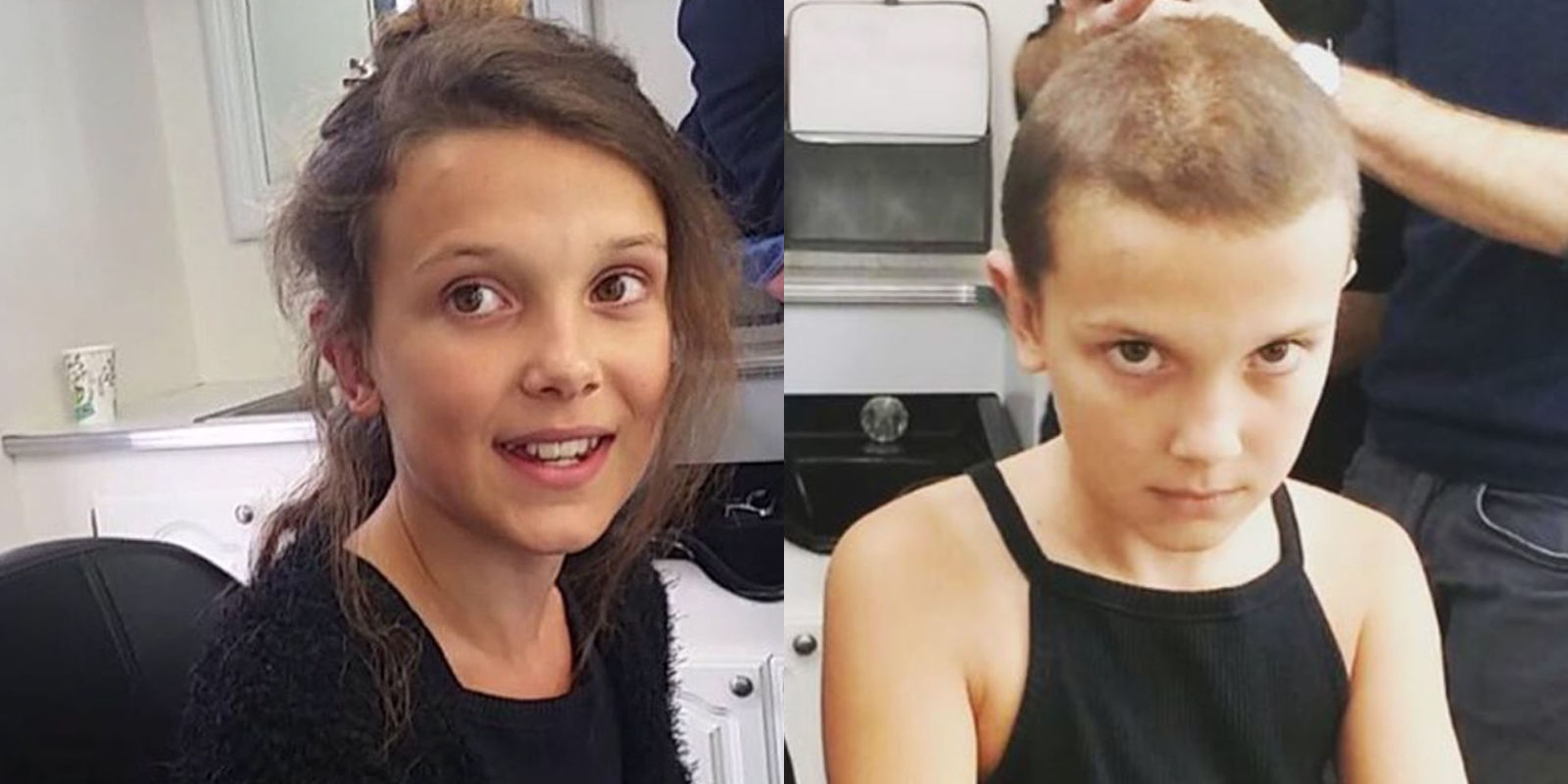 millie brown before and after